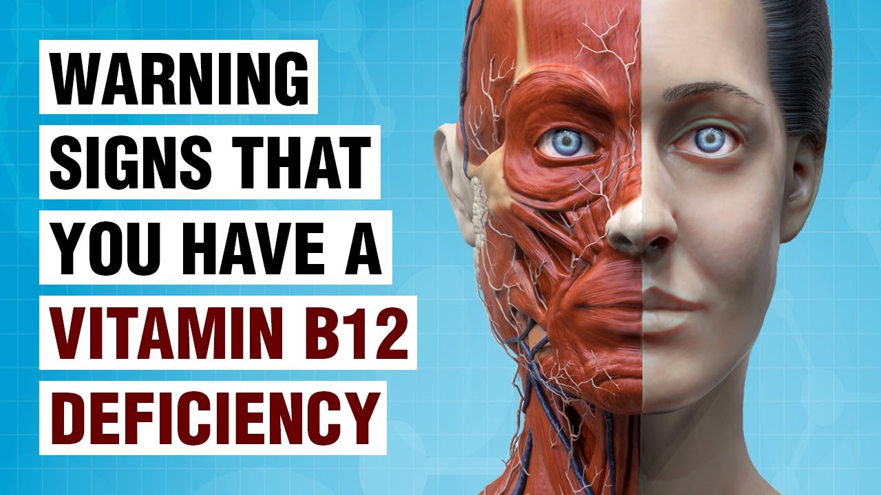 Vitamin B-12 Deficiency