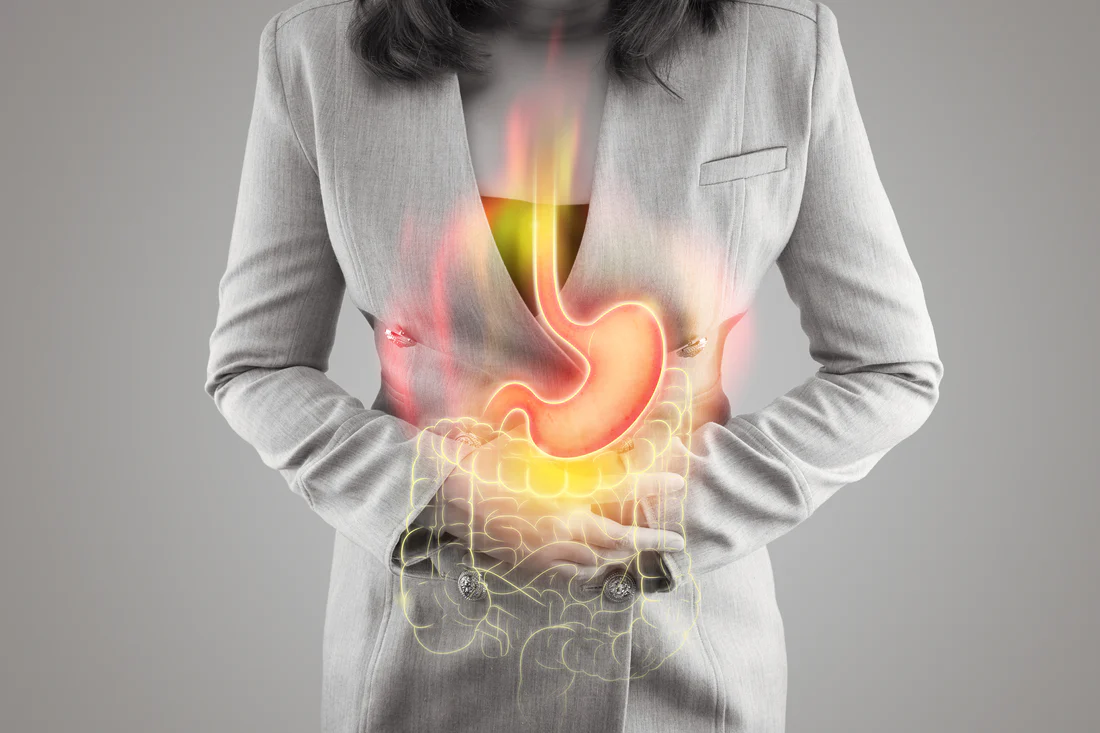 Natural Remedies for Acidity