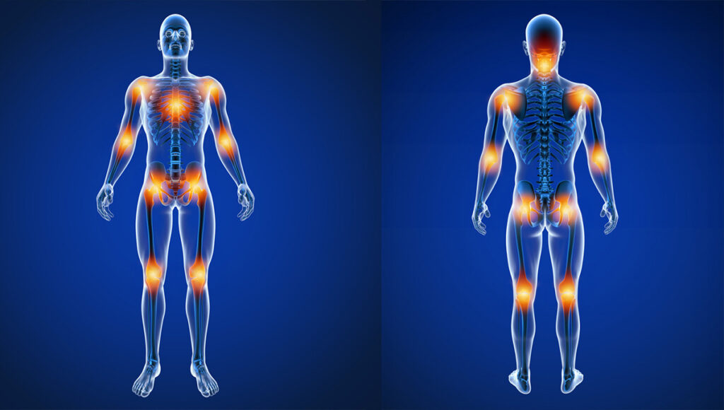 natural supplements for joint pain