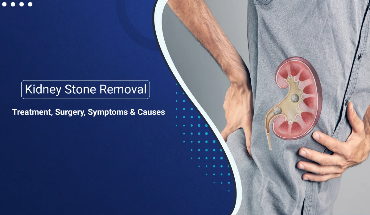 kidney stone treatment