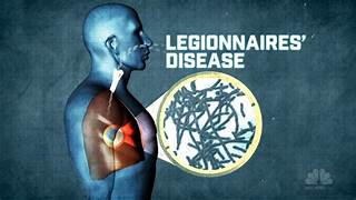 Legionnaires' Disease